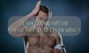 rụng tóc khi vuốt sáp